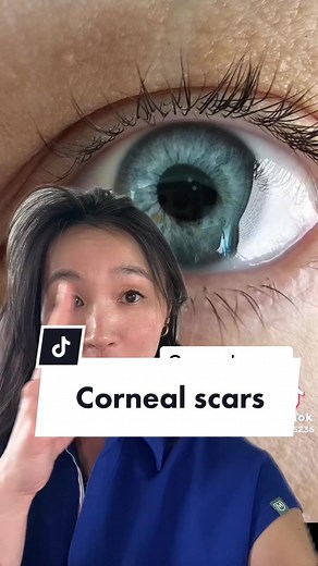 Corneal Scars: What Are Those White Dots?