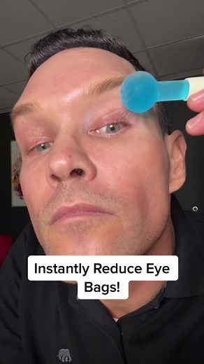Reduce Eye Bags with Ice Cubes