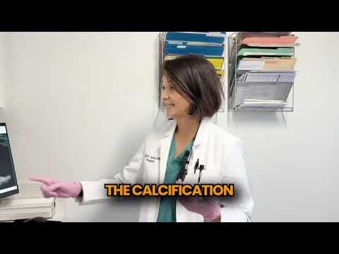 Back of Heel Pain? The REAL Cause (Heel Spur Explained)