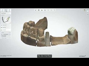 Performing a split bridge design