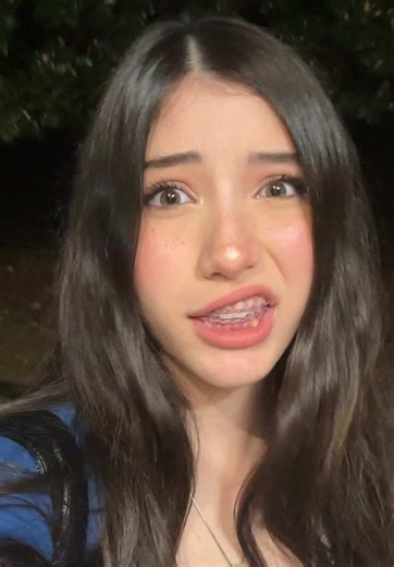 Thank You for 70K Followers — Braces Cringe Celebration