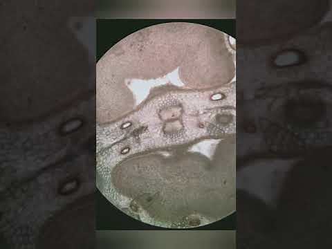 Fennel - morphology, histology, powder microscopy and chemical study