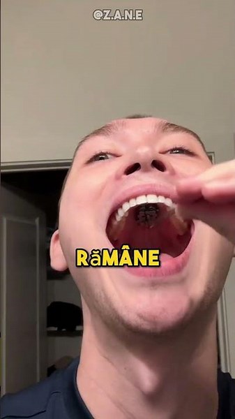 De ce are asta în gură