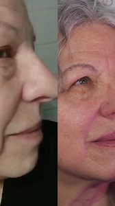 928K views · 5.4K reactions | Nasolabial folds gone in 7 days! Join the system to try face massage routine daily #facefitness #nasolabialfolds #smilelines #glowuptips #faceyoga Disclaimer: not a medical advice. For education purpose only. Consult with your physician if you have a medical condition. | Valeriia Veksler | Facebook