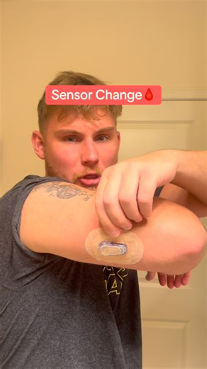 Alexander Tolwinski on Instagram: "#diabetes #sensorchange #dexcom #t1d #viral"