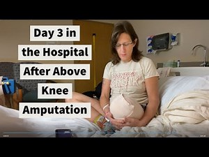 Amputation above the knee surgery day 3