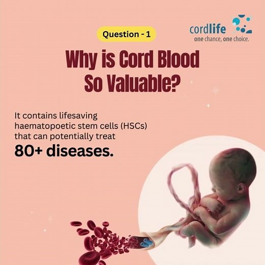 FAQ About Cord Blood Banking By Cordlife - [Part -1]