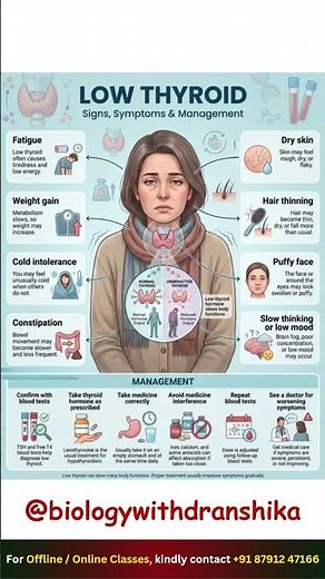 Low Thyroid (Hypothyroidism): Signs, Symptoms & Management. #hypothyroidism #thyroidhealth