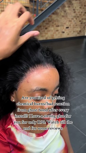 Chemical Burn Solution: Strong Glue for Safe Installation | Review Included