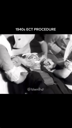 1940's ECT procedure