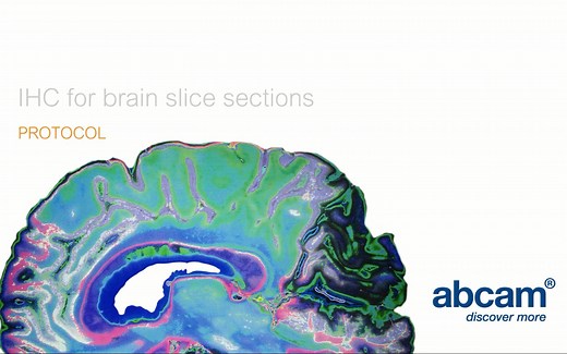 【教程】脑片的免疫组化染色（IHC for brain slice sections）