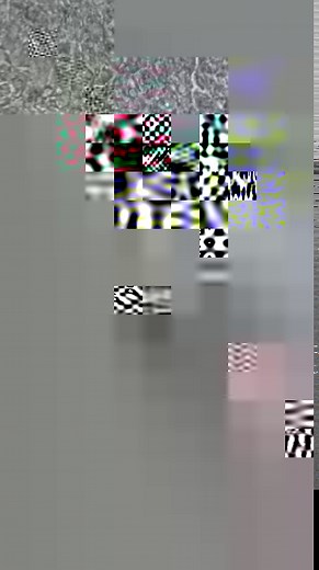 Beating cardiac cells aka cardiomyocytes ❤️ obtained by induced pluripotent stem cells. The movement is the pulse. #biomedicine #euracresearch #cardiomyopathy | Eurac Research