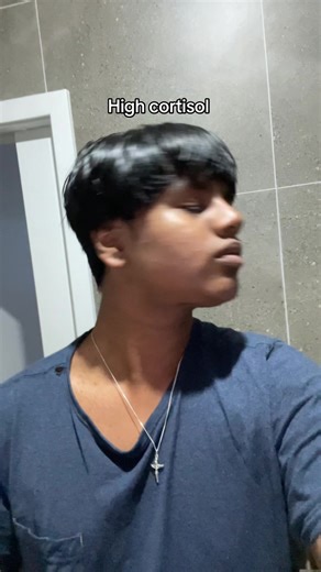 Understanding High vs Low Cortisol Levels