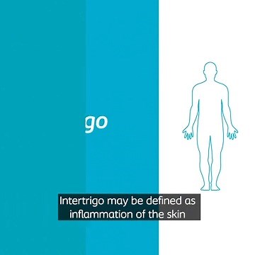 InterDry® targets all underlying causes of skin fold complications, also called intertrigo. The result? A proven approach for real relief. Visit our website to learn how InterDry can help resolve skin fold complications at your facility: https://www.coloplastprofessional.us/wound-care/campaign/interdry-specialist- page1?utm_source=wocn_society&utm_medium=organic_social&utm_campaign=interd ry_24_25&utm_content=wocn_society_organic_social Refer to product labeling for complete instructions includi