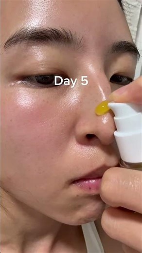 This best-selling capsule serum is packed with 3 keys.①dark spots②blackheads③skin barrier function