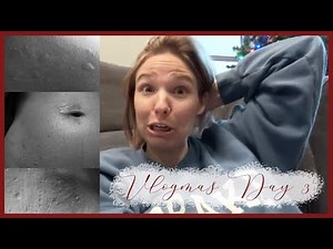 Allergic Reaction To CT Scan Contrast! | Vlogmas Day 3!