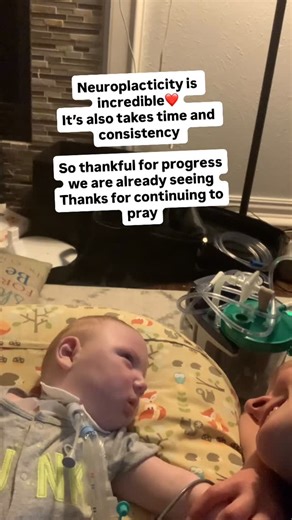 Hannah - Mom & Neuro Coach on Instagram: "We are so excited to jump into the doman Method. We have loved seeing the results others are getting and are thrilled by tiny steps we are already seeing! We appreciate your prayers. He hasn’t had much of a voice since the trach. Please pray with us his voice will come back soon❤️ He used to love to talk💔 #domanmethod #medicalmom #neuroplasticity #mom"