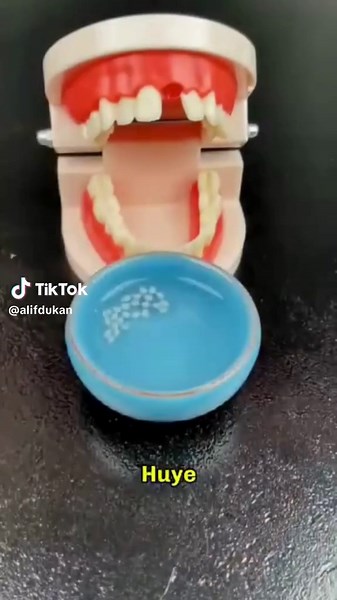 Tooth Repair Kit for Instant Confident Smile