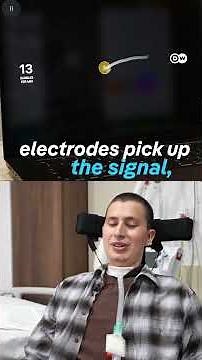 How the Neuralink brain chip enables a paralyzed patient to move again