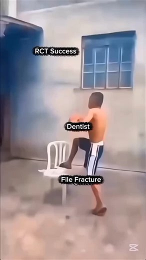 Dr. Yaseen on Instagram: "Yeah please use hypochlorite and sequential files. #dryaseen90s #viral #foryou #dentistry #dentist"