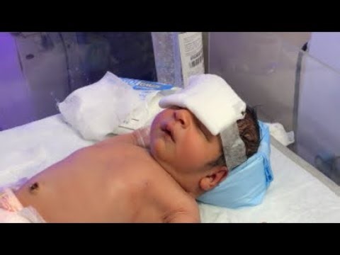 NICU Baby Recovery – Real Stories, Physio, & Shocking Transformations