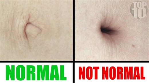 10 Weird Body Clues That Reveal Health Secrets