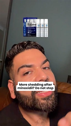Shedding after starting minoxidil doesn't mean it's failing.