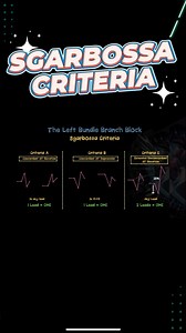 3.8K views · 37 reactions | Sgarbossa Criteria A & B Concordant ST elevation ≥ 1 mm in ≥ 1 lead Concordant ST depression ≥ 1 mm in ≥ 1 lead of V1-V3 | FOAMfrat | Facebook