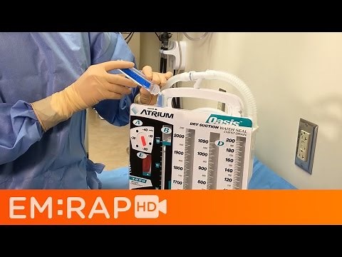 How to Setup a Single Collection Chest Drain