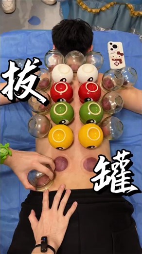 YuanLaiKePu on Instagram: "How cupping therapy works and why suction is created"
