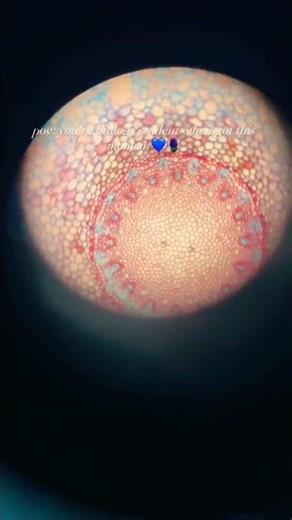 POV: You finally get the perfect view under the microscope ✨🌱