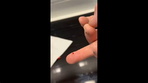 Satisfying Splinter Removal