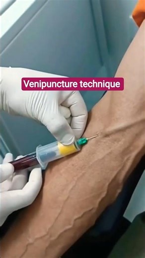 Venipuncture technique for blood collection...#bloodcollection #labtechnician #bmlt #ytshorts #song