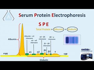 الترحيل الكهربائي للبروتينات Protein Electrophoresis