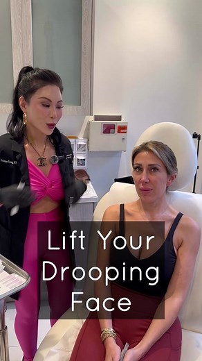 Threads 🪡 This patient did a full face thread lift consisting of our signature vertical thread lift, cheek pop and snatched jaw line 🤗 All to lift the superficial fat pads and achieve these beautifully snatched results 🥰 Let us know what you think down below ⬇️ #fyp #pdothreads #threads Don’t miss out on your chance for a confidence boost! Book a consultation today and discover the possibilities! 📞 (949) 760-1985 individual results may vary