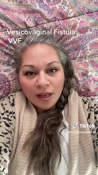 Vesicovaginal Fistula Story Time: A Journey of Recovery and Support