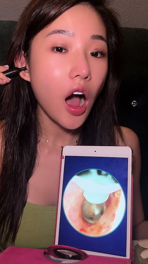 Satisfying Ear Cleaning Tool: Real Visuals, Easy to Use