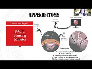 Appendectomy! What to expect from a patient presenting with acute appendicitis.