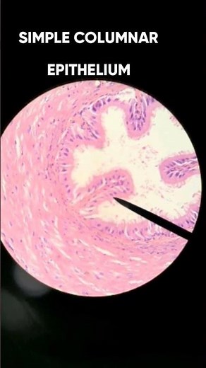 Epithelial tissue histology slides (Pathology) part 1