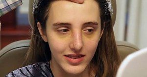 Bullied Teens Using Free Plastic Surgery to Avoid School Torment