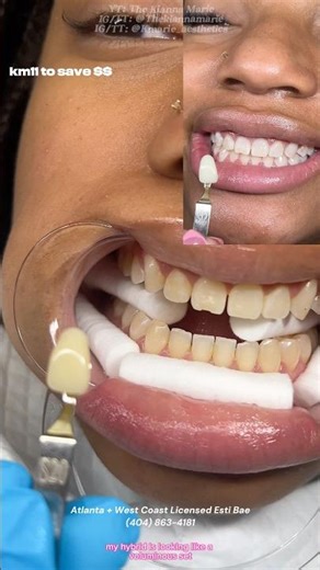 #lashartist #lashtech #atl #vegas #fy #losangeleslashes #skincare #esthetician #teethwhitening #fyp