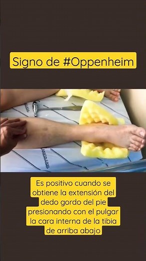 #Signos de #Oppenheim #medicina #neurologia