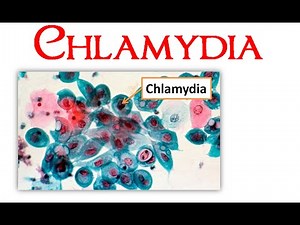 Chlamydia