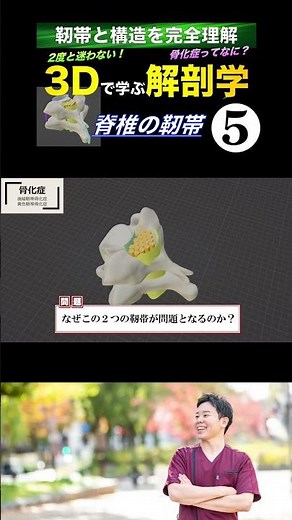 骨化症と神経症状 脊椎の靭帯 これを見ればもう迷わない！【3Dで学ぶ解剖学】#後縦靭帯骨化症 #脊椎 #黄色靭帯骨化症