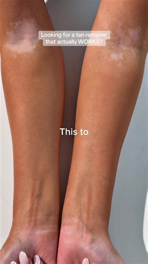 Effective Deluxe Tan Remover for Smooth Skin
