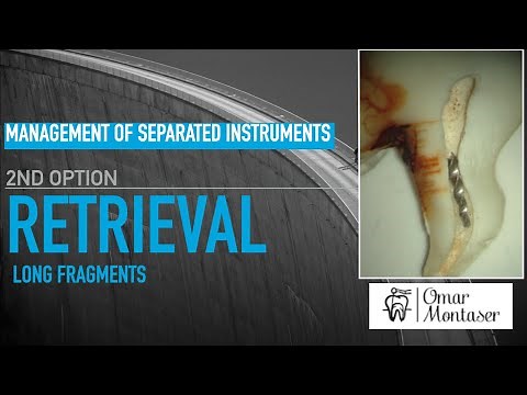 Removal of Long Broken Files