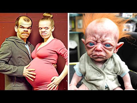 They Were Warned Not to Have Children, but They Didn't Heed - Most Unusual Births in the World