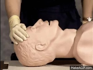 Head tilt chin lift on Make a GIF