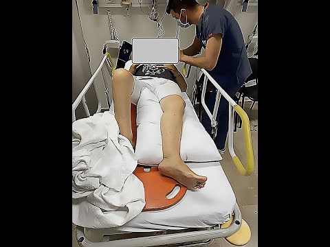 Reduction Maneuver of Anteriorly Dislocated Hip Prosthesis