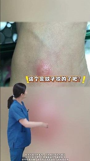 Master the Art of Identifying Bug Bites in Just 1 Min